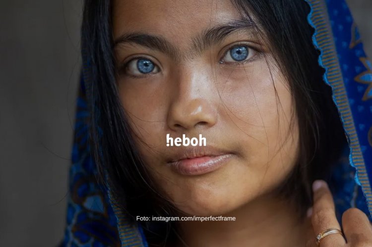 Viral Gadis Asal Jabar Memiliki Mata Biru, Jadi Incaran Fotografer Dunia