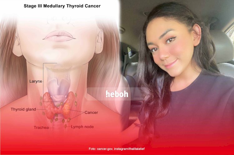 Mengenal Tumor Tiroid yang Diderita Thalita Latief